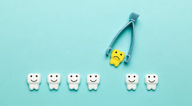Oralchirurgie - Übersicht der Behandlungen aus der Oralchirurgie auf einen Blick